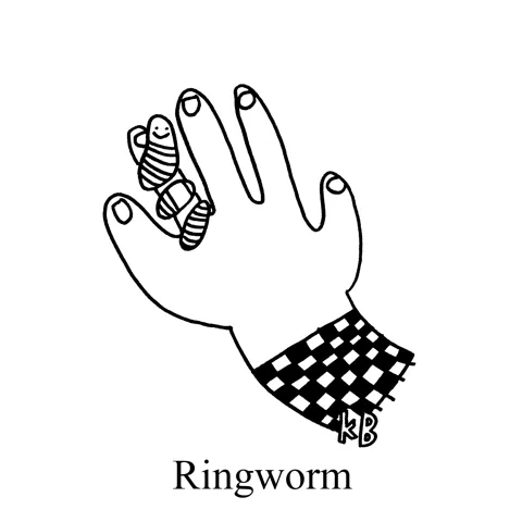 In this pun on the fungal infection ringworm, we see a very cute earthworm wrapped around a human finger like a ring. This, of course, is a far more desirable form of ringworm. 